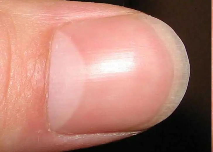 26 cosas que tienen nombre y no los conocías.