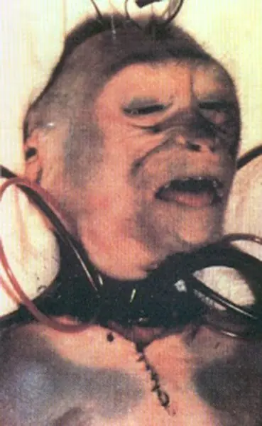 primer transplante