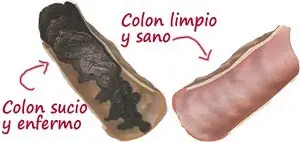 Como Limpiar Tu Colon y Libera 4 Kilos de Desechos En 5 Dias