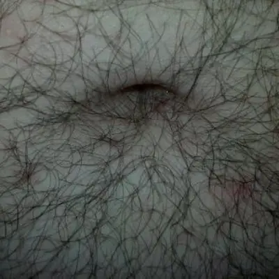 peludo