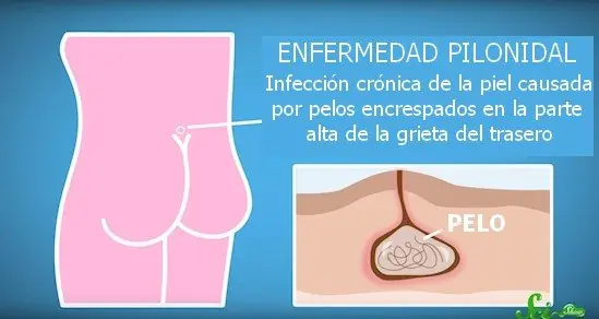 Pelos