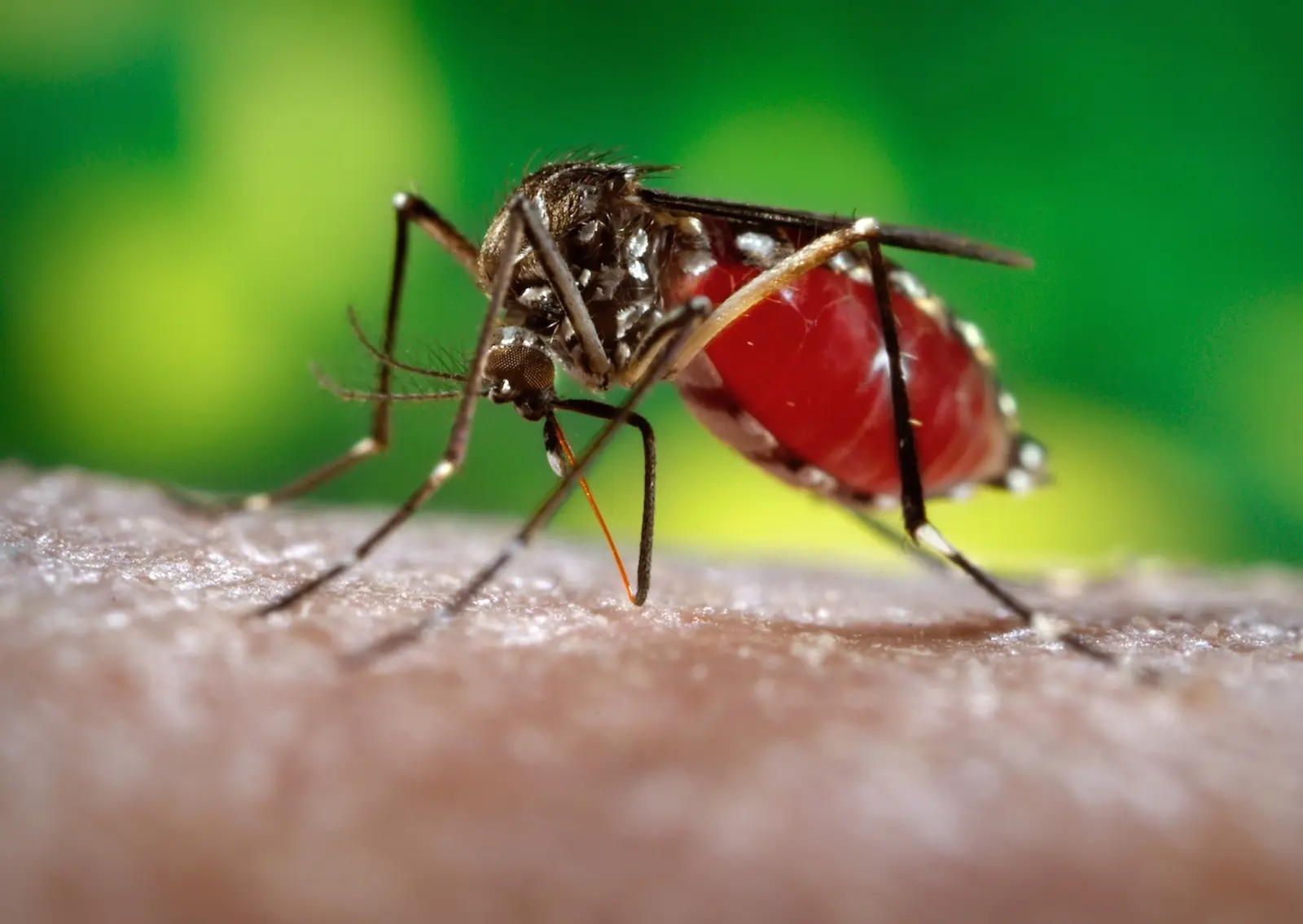 El Zika Podría Estar Relacionado con Otra Enfermedad