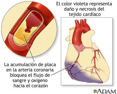 corazon