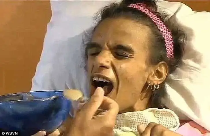Hermosa chica se operó los pechos y fue la peor tragedia