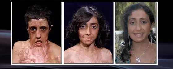 cirugia reconstructiva