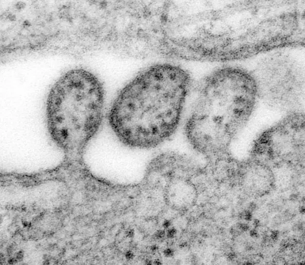 ebola