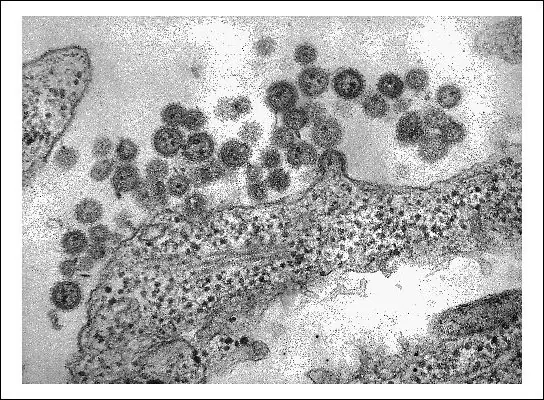 virus
