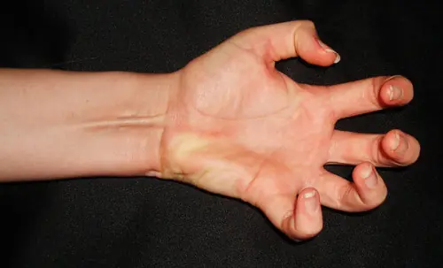 partes del cuerpo