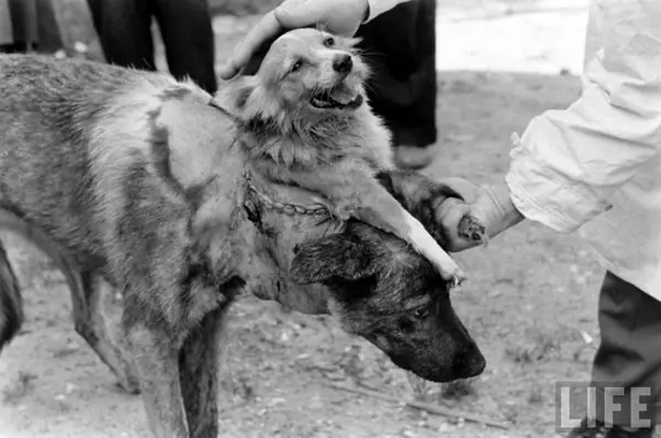 Trasplante De Cabeza Humana "Real"