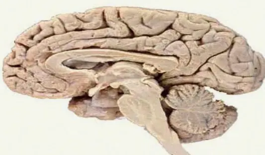 cerebro