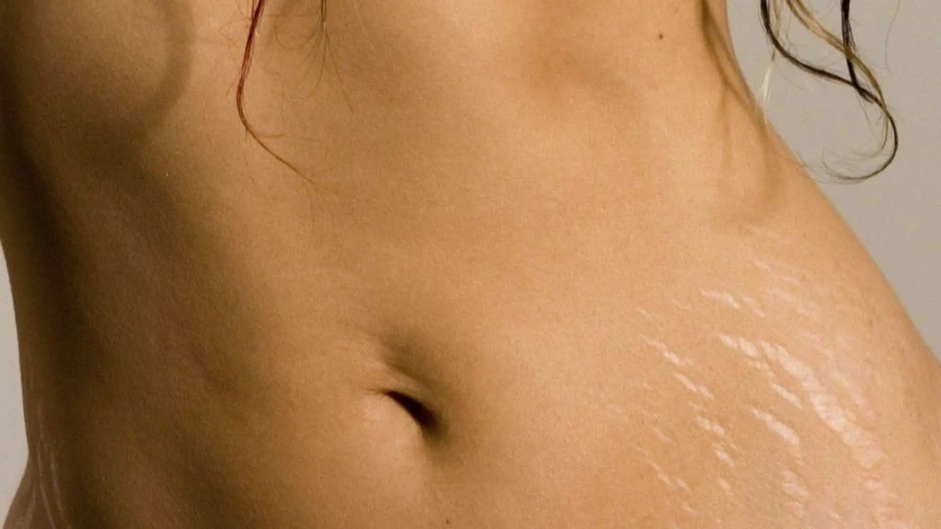 CELULITIS
