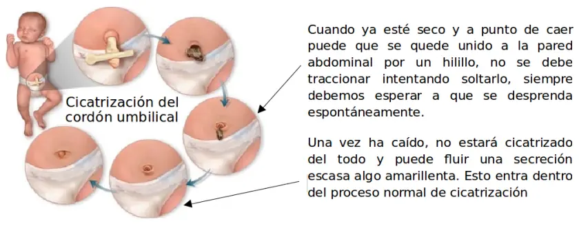 recien nacido