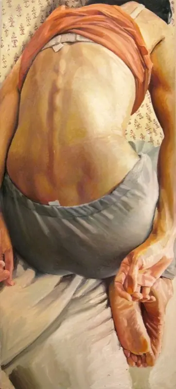 figurativo