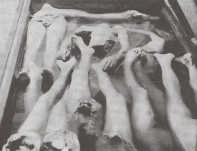 Algunos experimentos nazis en personas