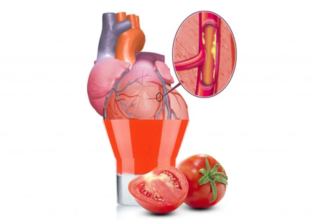 frutas