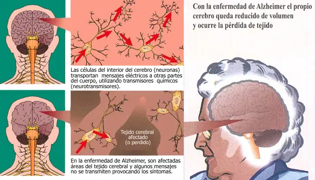 enfermedades