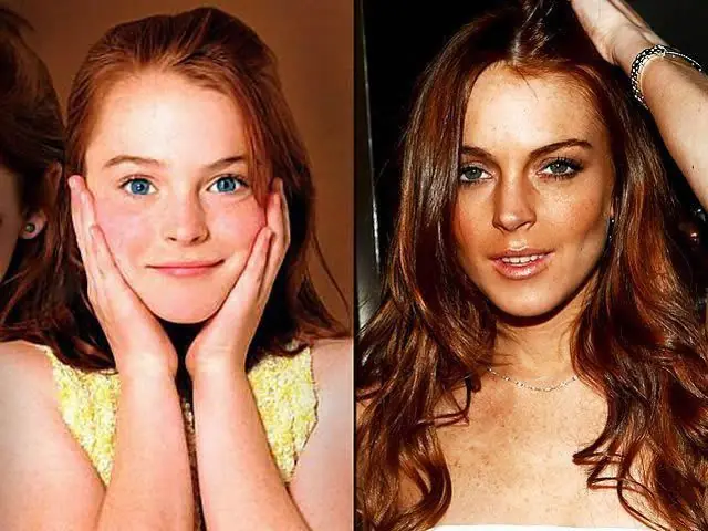 antes y despues