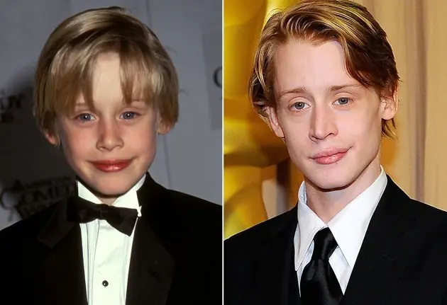 famosos antes y despues