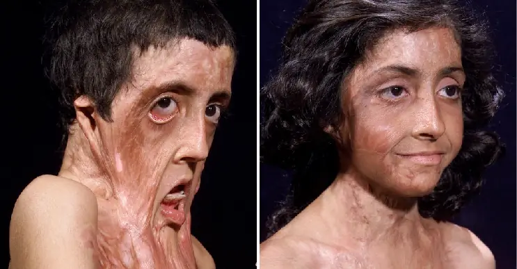 Doctor le cambia la vida a nina tras operarla