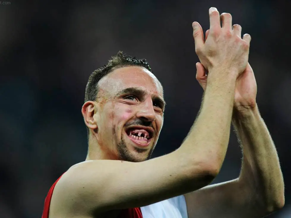 Te tromues 6 futbolistas que photoshopearon sin dientes