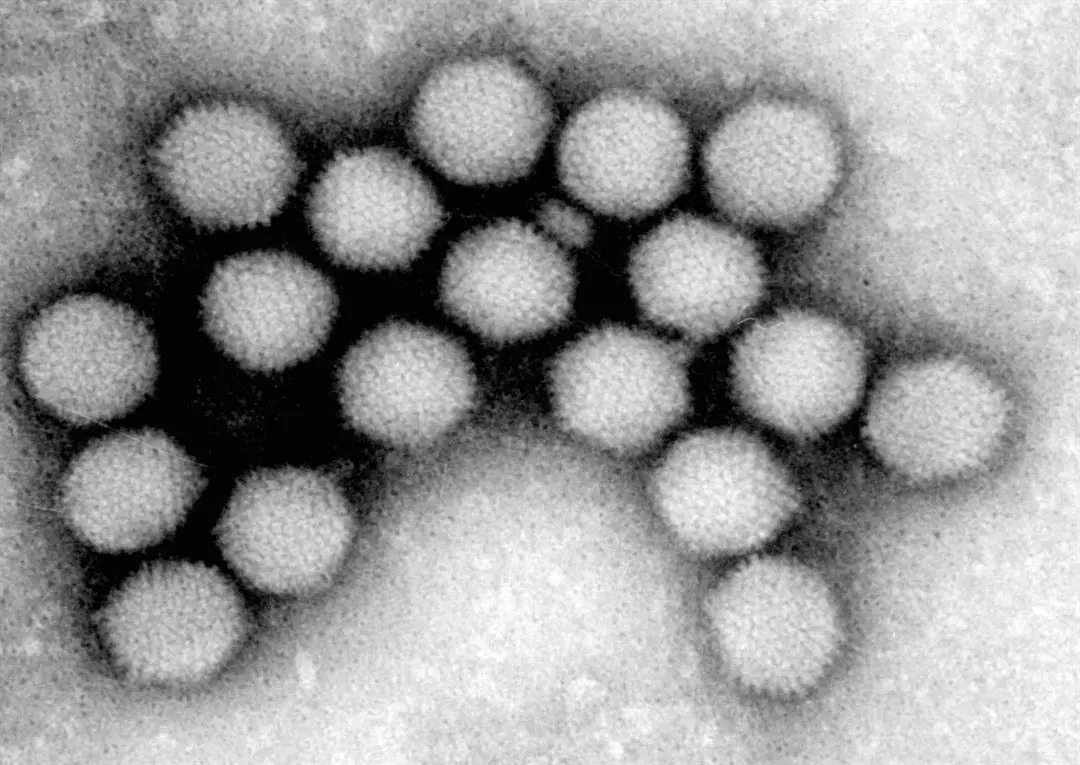 virus