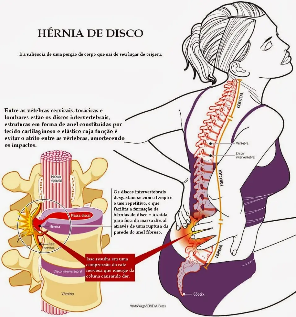 dolor de espalda