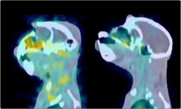Así se ve la infección del SIDA en vivo