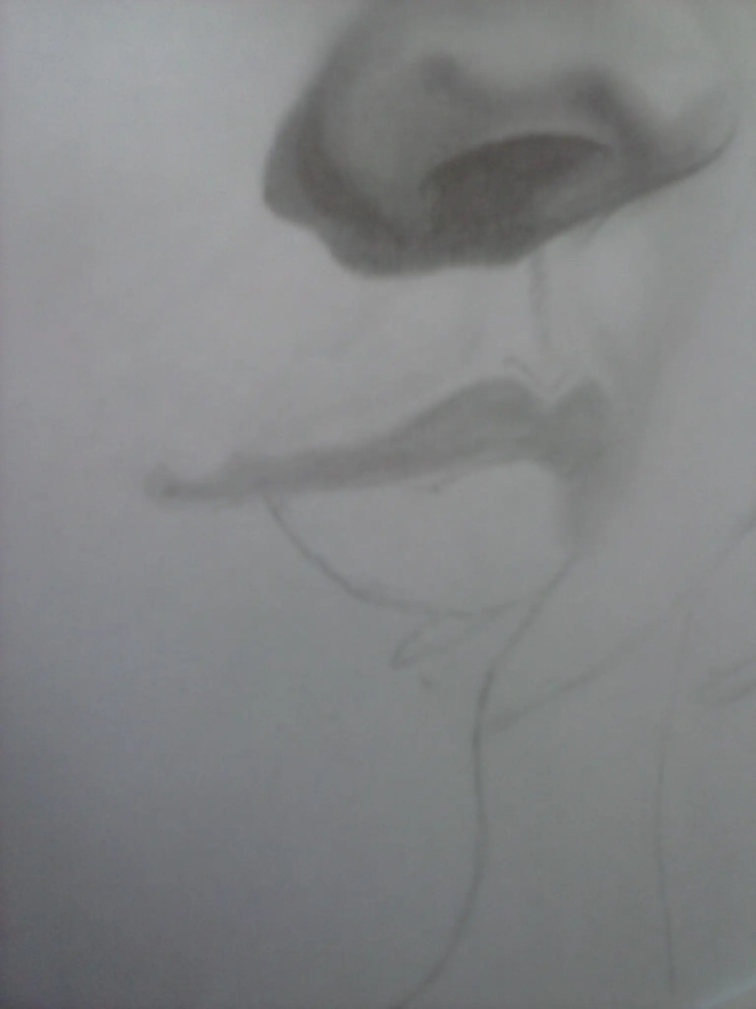 retrato