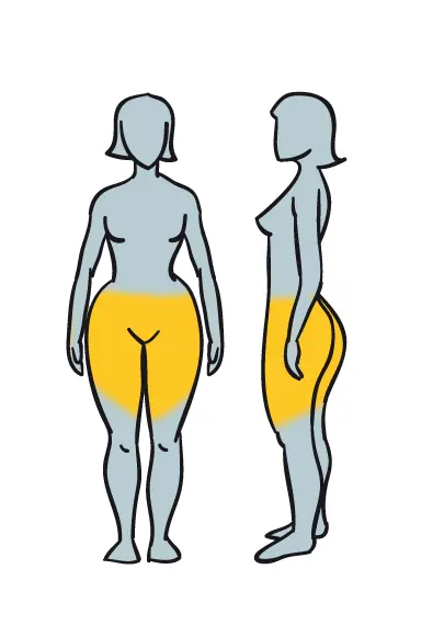 Hay 6 tipos de obesidad, ¡Mira cuál es el tuyo y elimínalo!