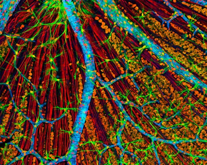 adn