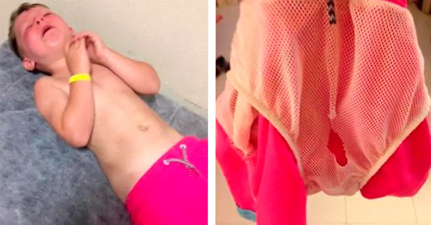 Nunca dejes que los niños usen traje de baño con malla