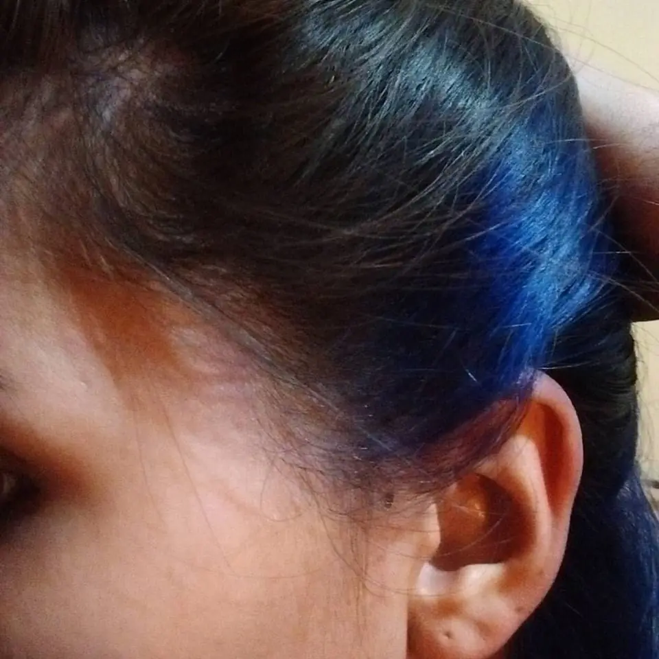 pelo pelo