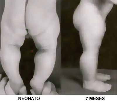 humanos