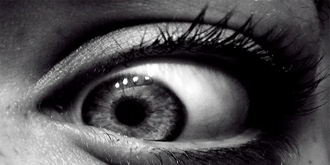 5 cosas para las que el Bótox sí te puede ayudar