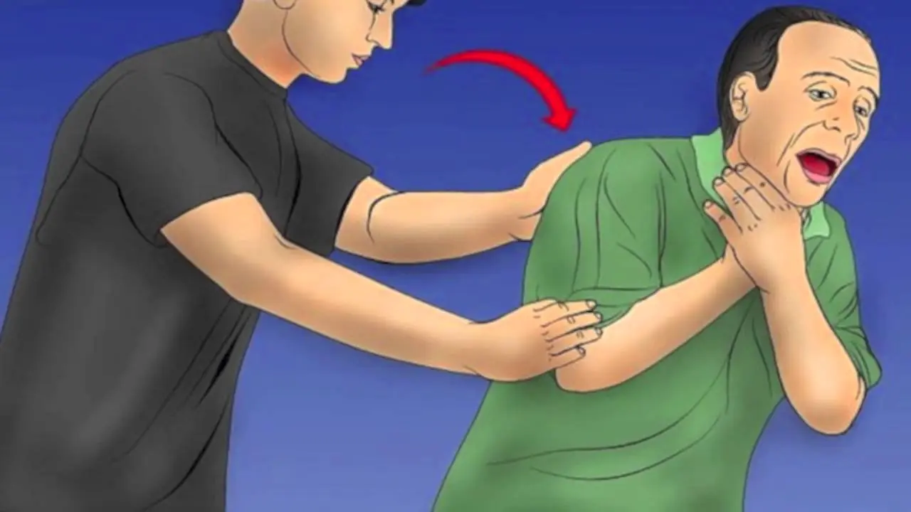 Heimlich