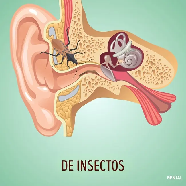 No&nbsp;limpies tus oídos con contonetes!