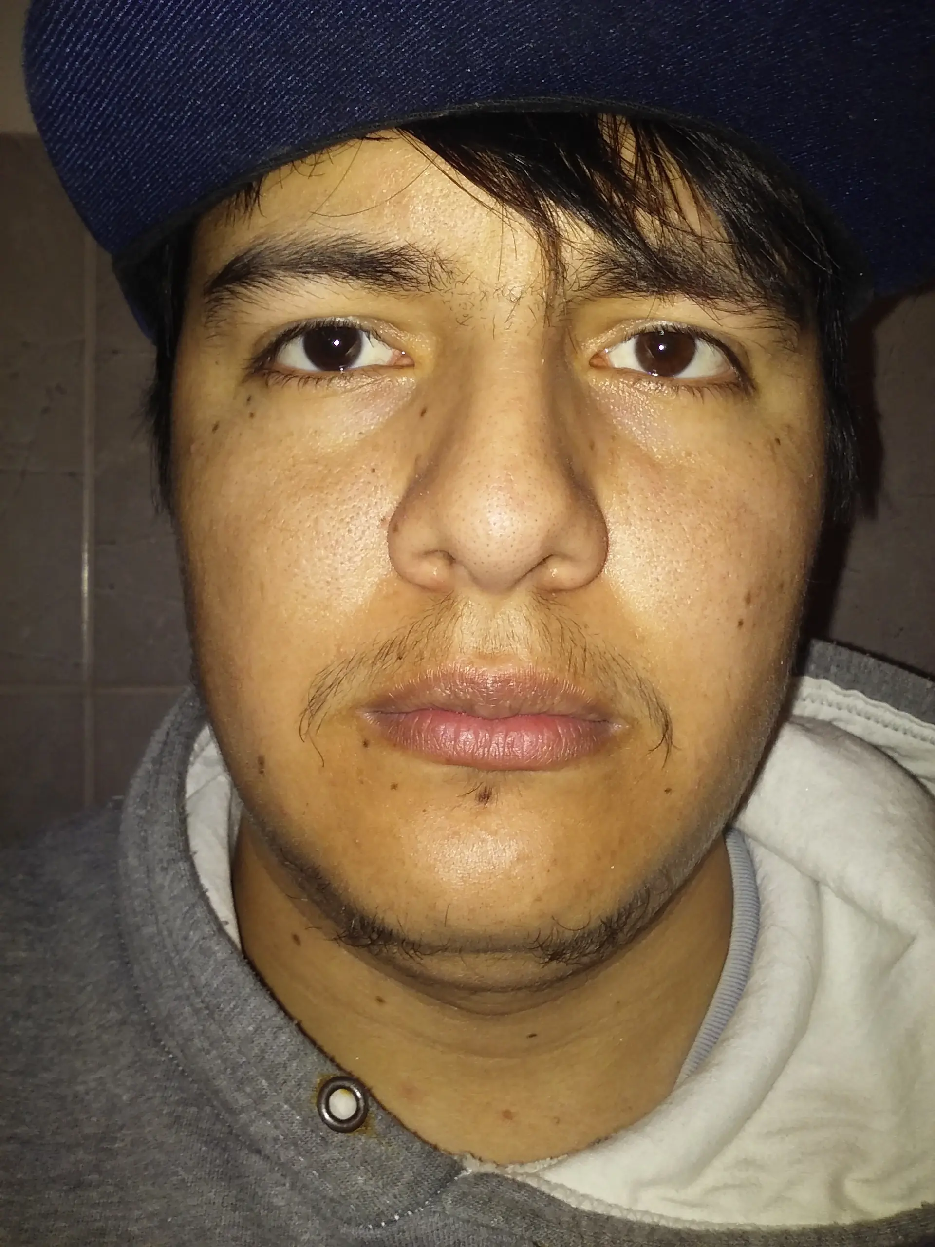 tratamiento