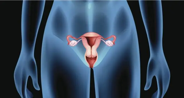 mujer