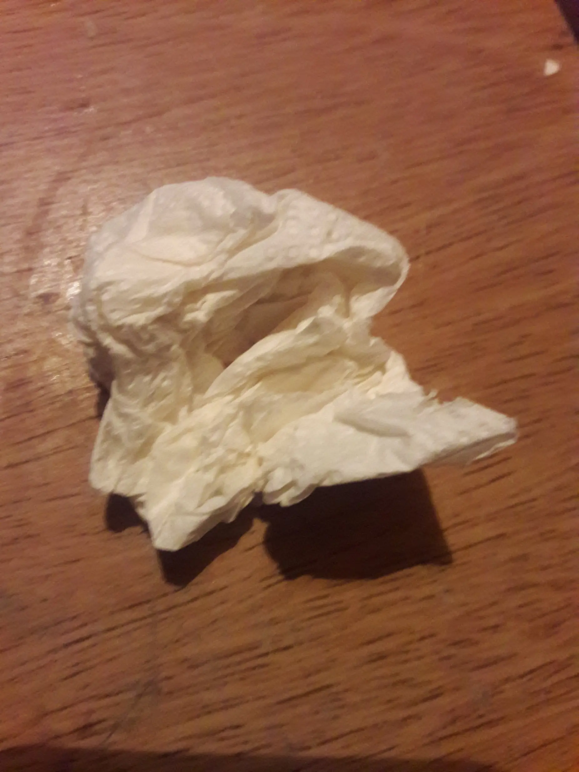 Tengo un grano en el culo, se me cayo el mundo, certificada