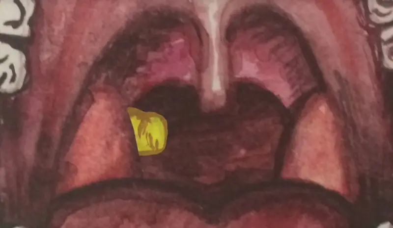piedras