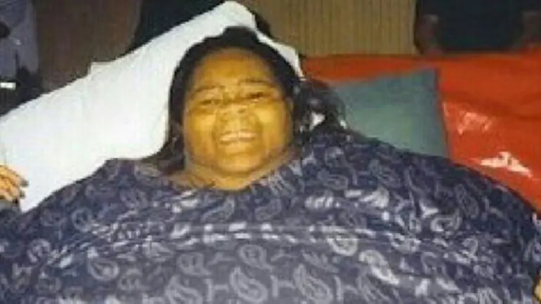 Cómo queda el cuerpo de alguien que pierde 230 kilos
