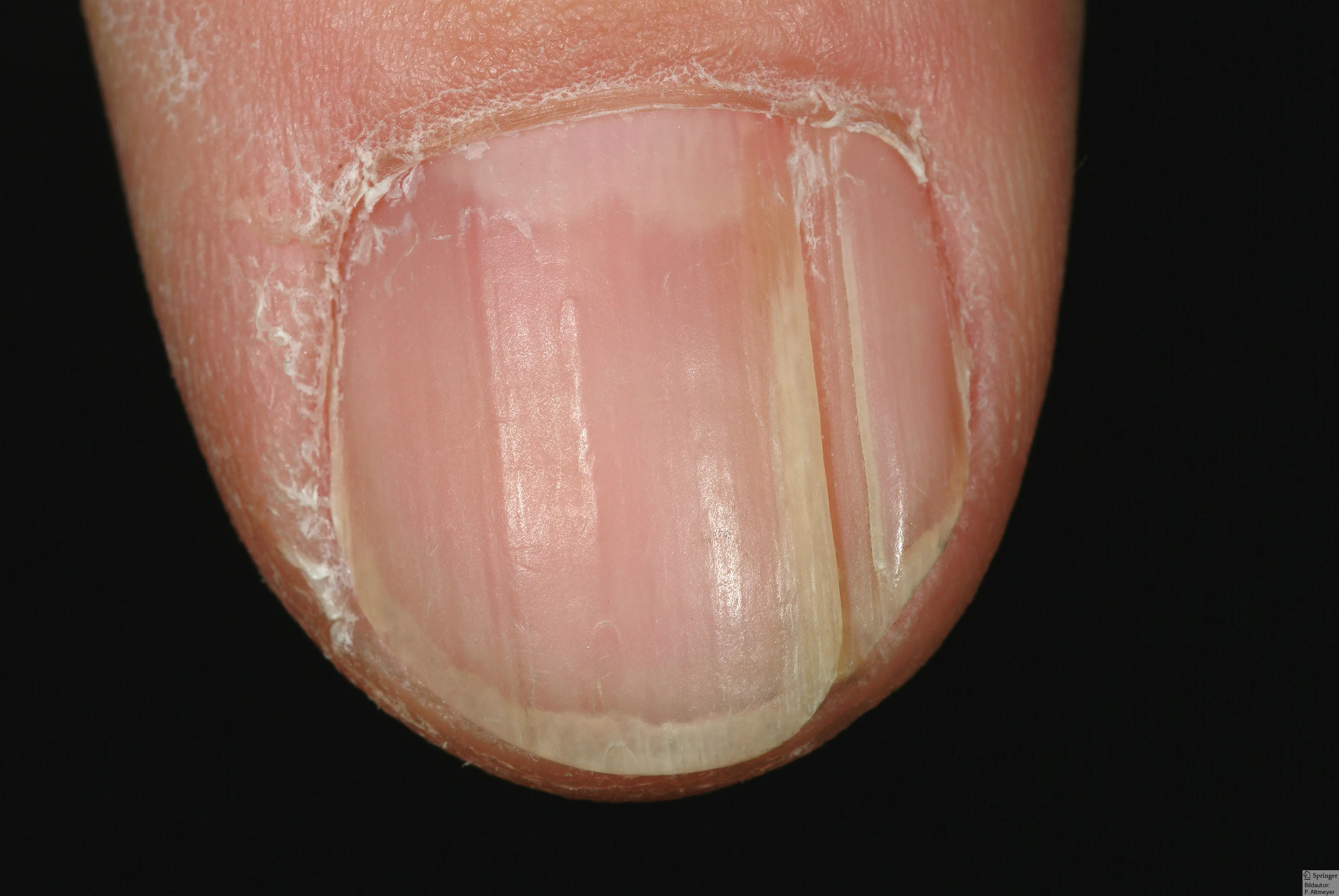 Uñas: El Mega-post que se merecen (inteligencia-colectiva)