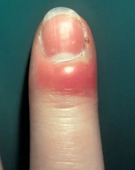 Uñas: El Mega-post que se merecen (inteligencia-colectiva)
