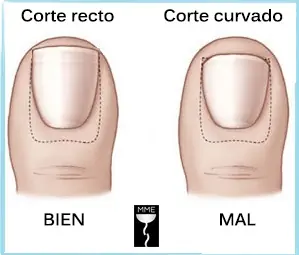 pies