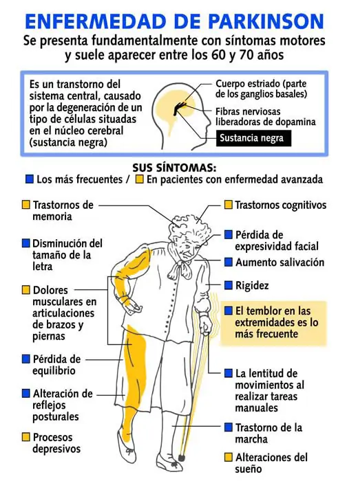 Que es la enfermedad de Parkinson ?
