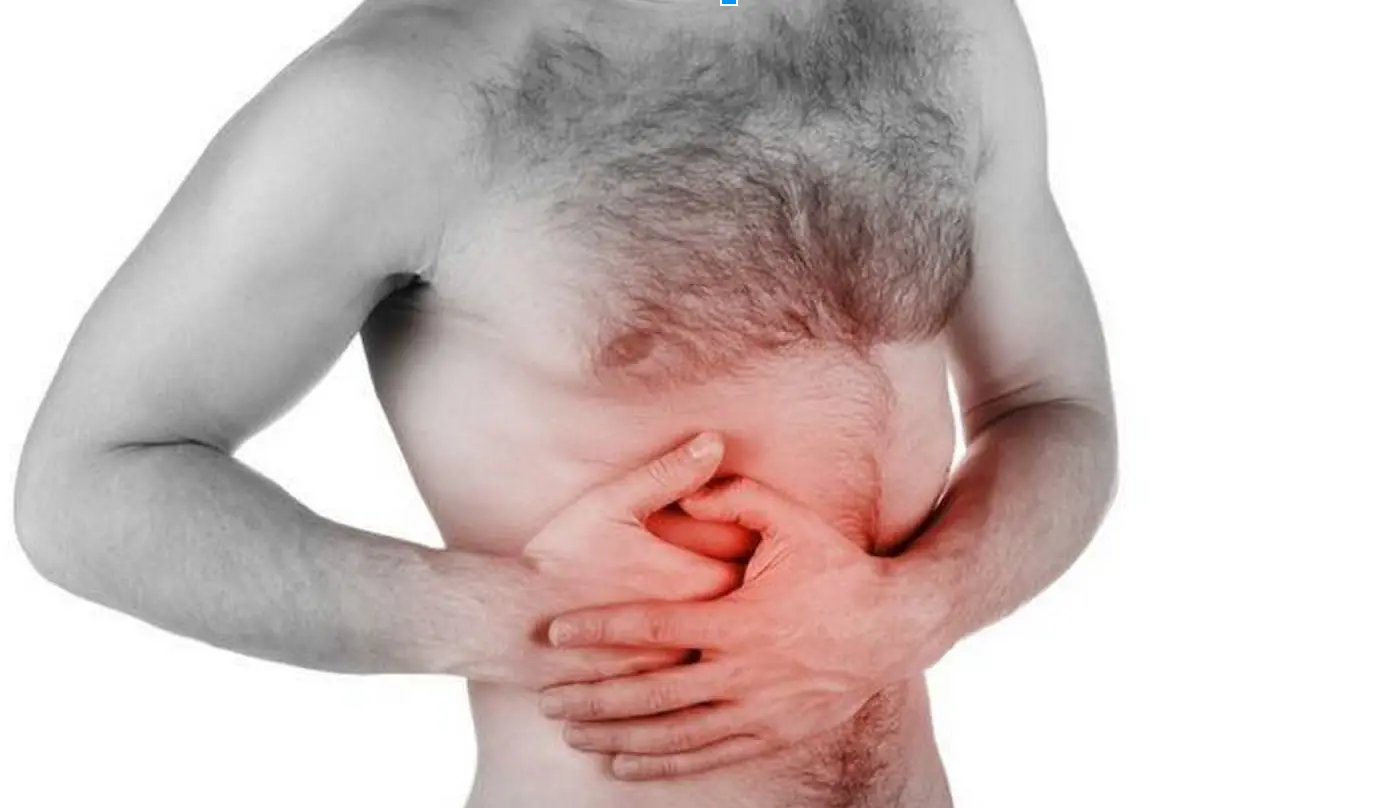 peritonitis