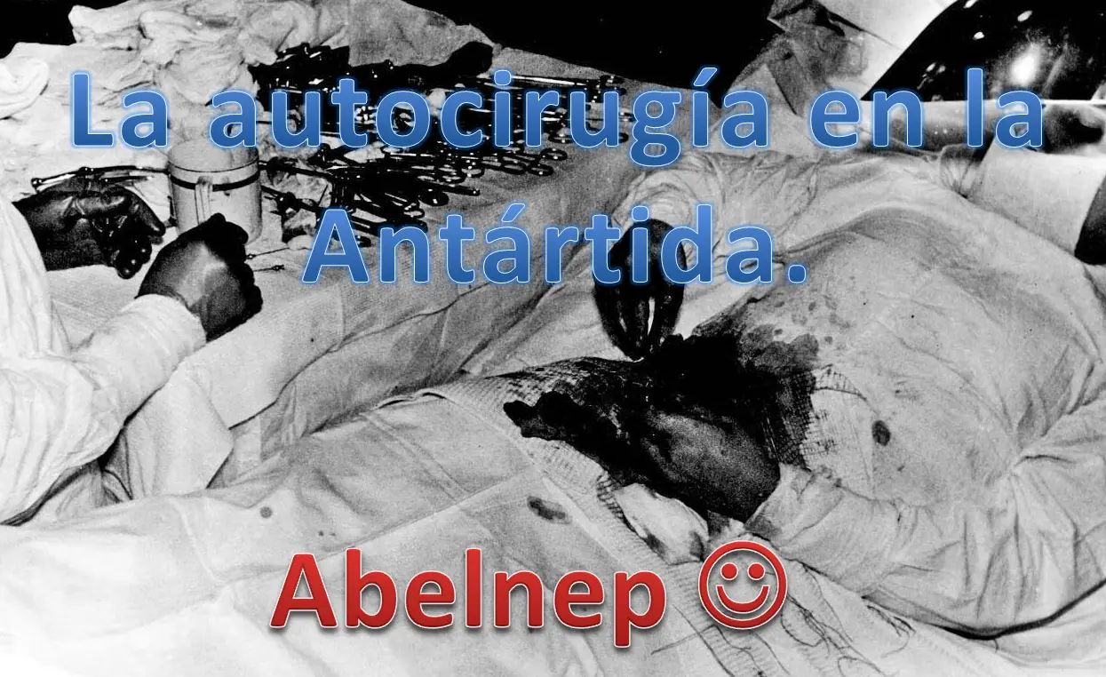 apendicitis