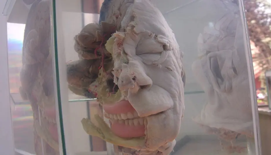 Peru: Inusual Museo del Cerebro abre sus puertas