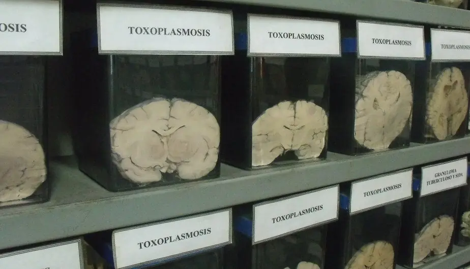 Peru: Inusual Museo del Cerebro abre sus puertas
