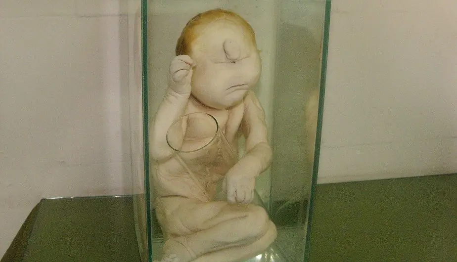 cuerpo humano